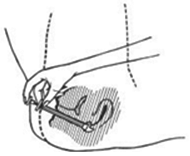 C0534303