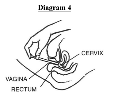 C0925104