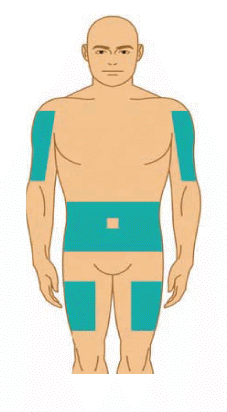 CGAMUNE10