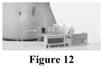 CHIZEAU12