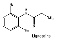 CSLIGNO2.gif