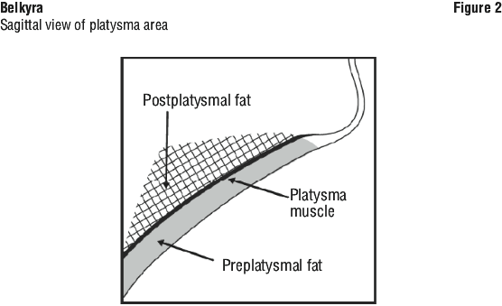 BELKFIG2.gif