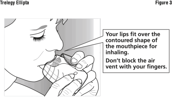 TRELFIG3.gif